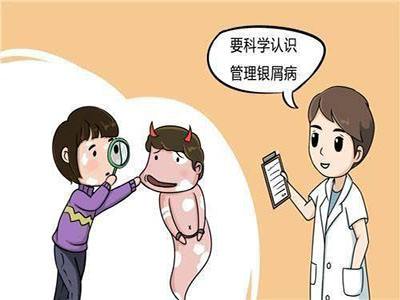 银屑病预防措施