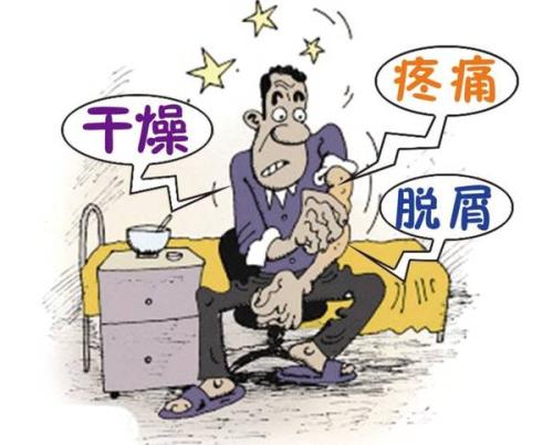 银屑病加重趋势
