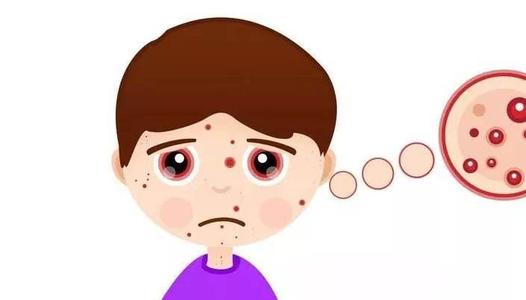 脸上牛皮癣能掉吗