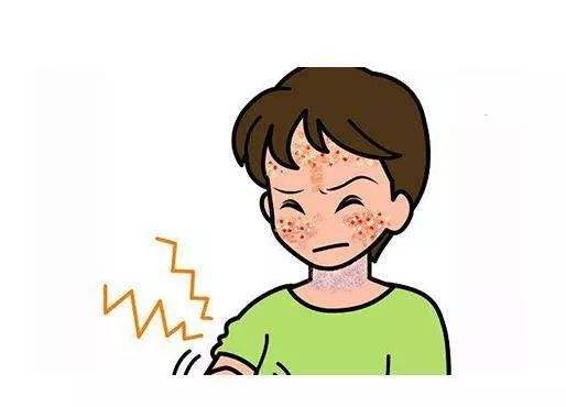 论被多年牛皮癣缠身小伙子精神奔溃