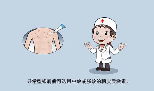 父亲牛皮癣儿子会有吗