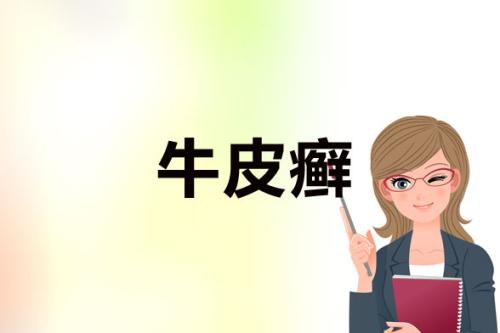 生活中的牛皮癣