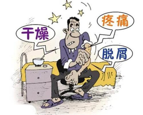 牛皮癣如何抗复发