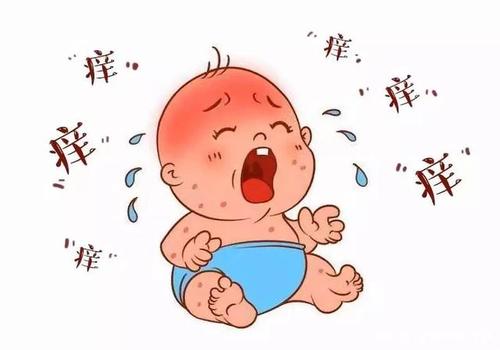 牛皮癣可能不复发吗