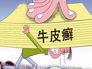 银屑病究竟能不能治好