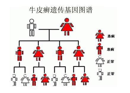 治疗牛皮癣中药