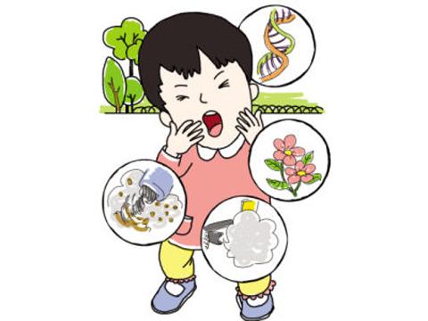 牛皮癣发病因素