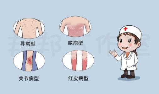 牛皮癣类型