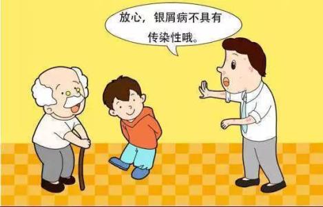 牛皮鲜会传染吗