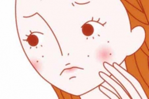 牛皮鲜患者如何使用激素
