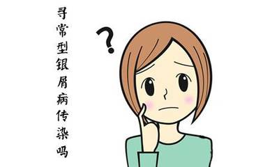 牛皮癣发生性关系传染吗