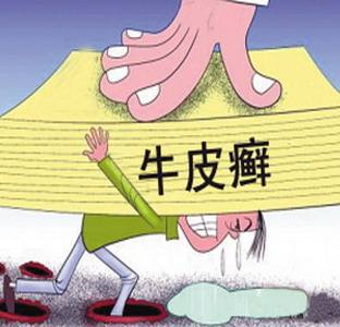 内分泌导致牛皮癣发病