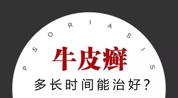 春季牛皮癣复发诱因