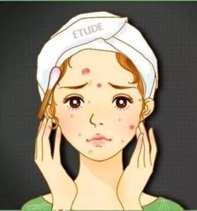 如何治疗牛皮藓