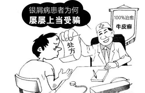 孩子患上银屑病怎么治