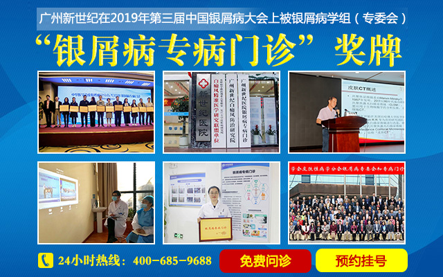广州新世纪医院看银屑病怎么挂号