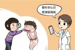 牛皮癣发病症状