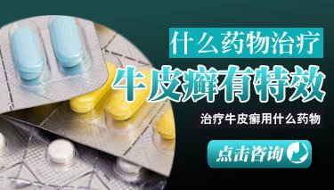 银屑病吃什么药