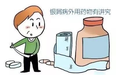 牛皮癣抗复发攻略