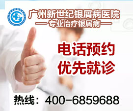 问广州治疗银屑病哪家医院好