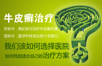 牛皮癣患者需要正视自己的疾病