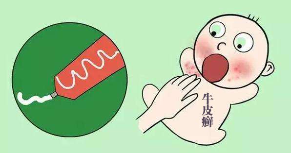 牛皮鲜会传染人真的吗