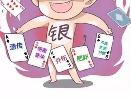 牛皮癣顽固咋办