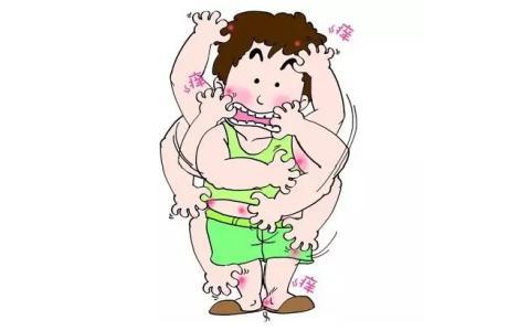 身有银屑病瘙痒难耐怎么办