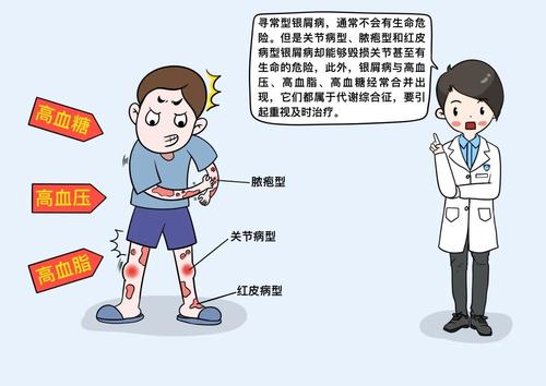 牛皮癣的危害